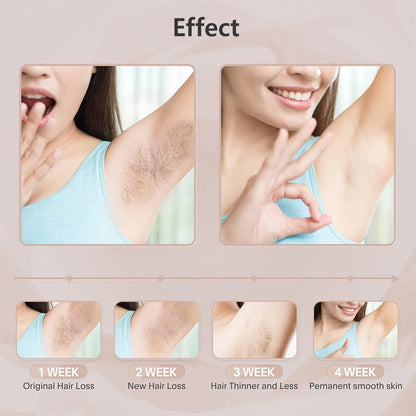 Professional IPL Laser Hair Remover 990000 Flashes for Women & Men - Painless, Permanent Hair Removal for All Body Areas